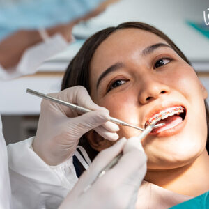 A Guide To Orthodontic Options In Singapore