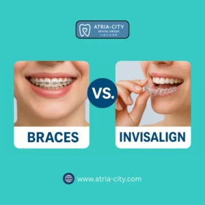 Braces vs Invisalign