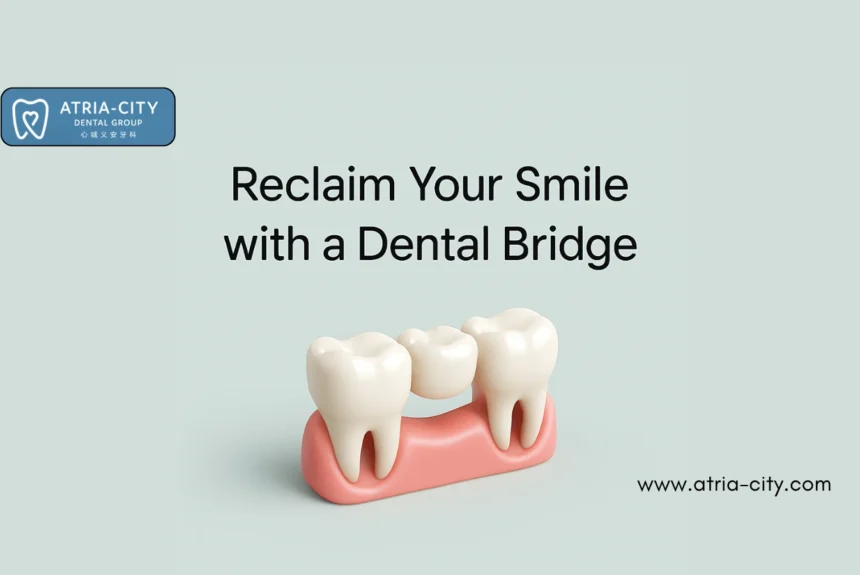 Dental Bridges in Singapore Atria-City Dental Dental Bridges in Singapore Atria-City Dental