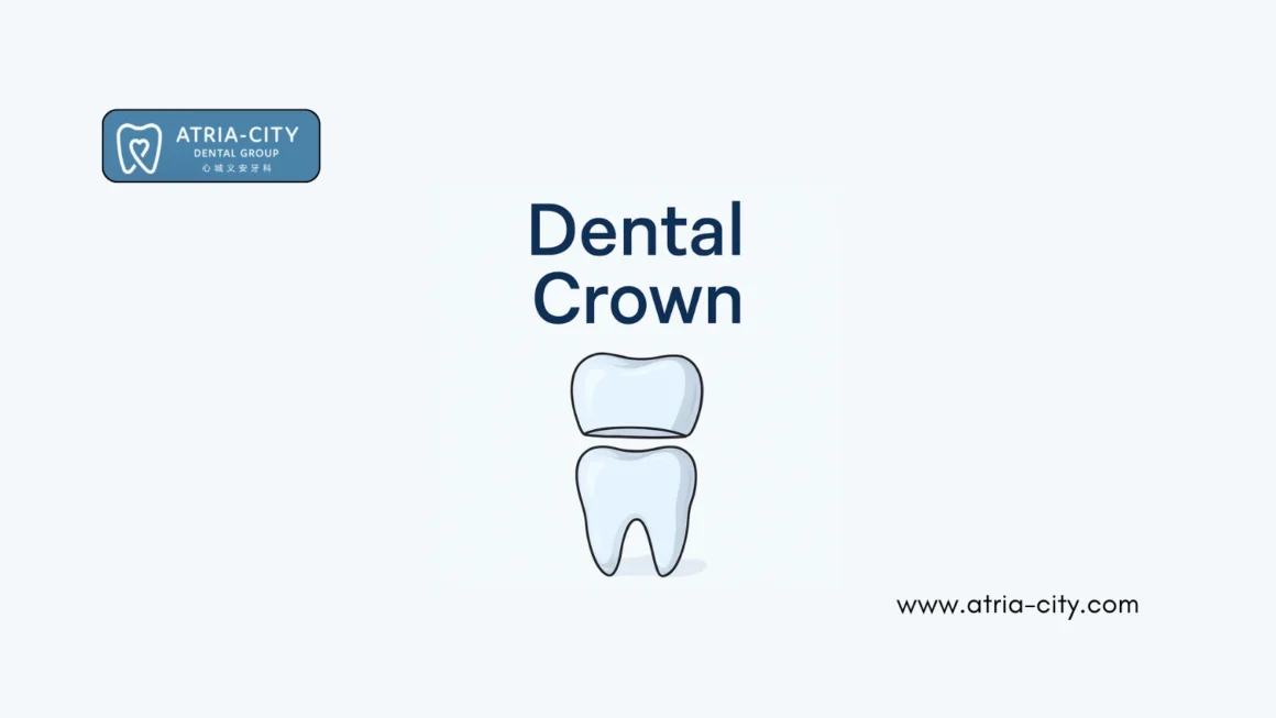 Dental Crown Treatments in Singapore