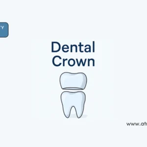 Dental Crown Treatments in Singapore