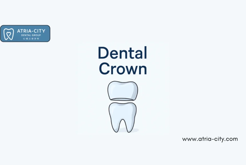 Dental Crown Dental Crown Treatments in Singapore
