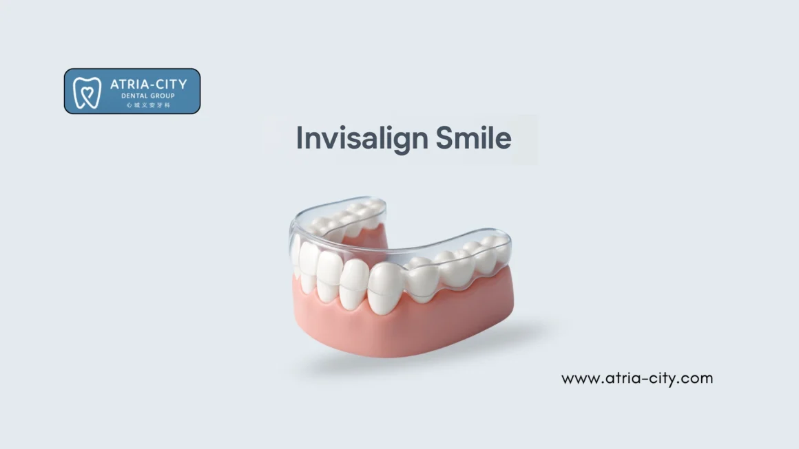 best Invisalign clinic _ Atria-city