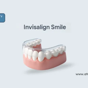 best Invisalign clinic _ Atria-city