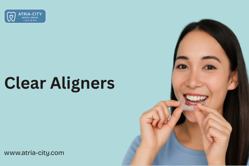 Clear Aligners in singapore Clear Aligners in singapore