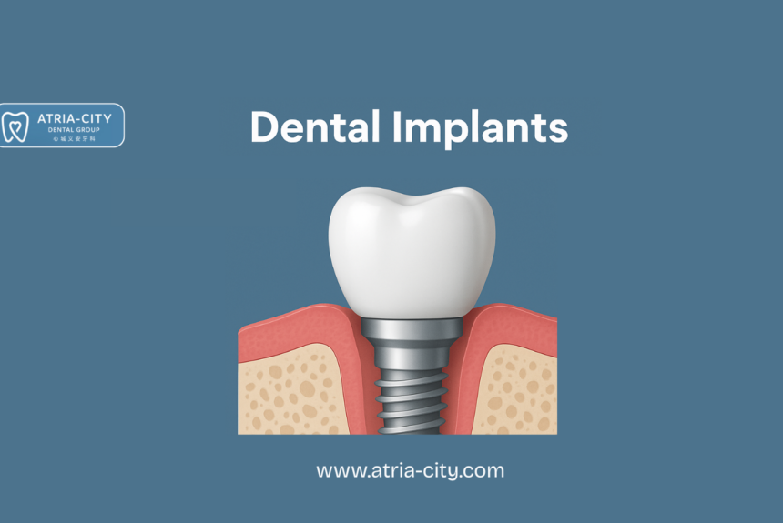 Dental Implants Cost in Singapore Dental Implants Cost in Singapore