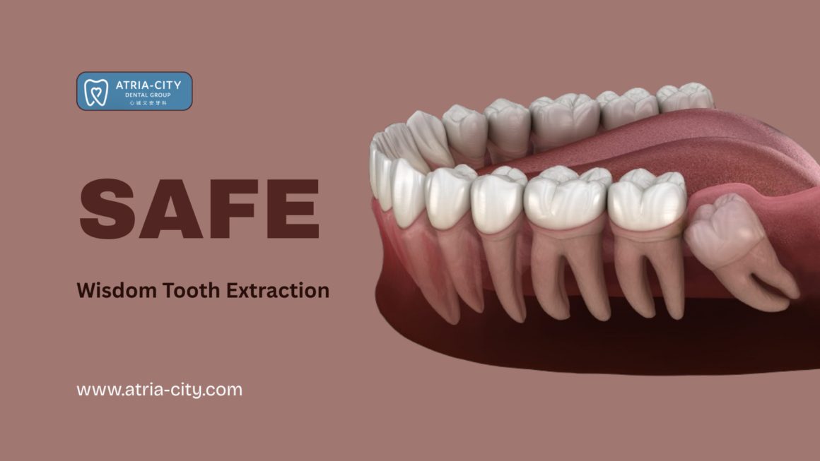 Safe Wisdom Tooth Extraction in Singapore | Atria-City