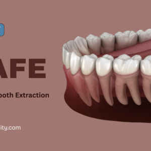 Safe Wisdom Tooth Extraction in Singapore | Atria-City