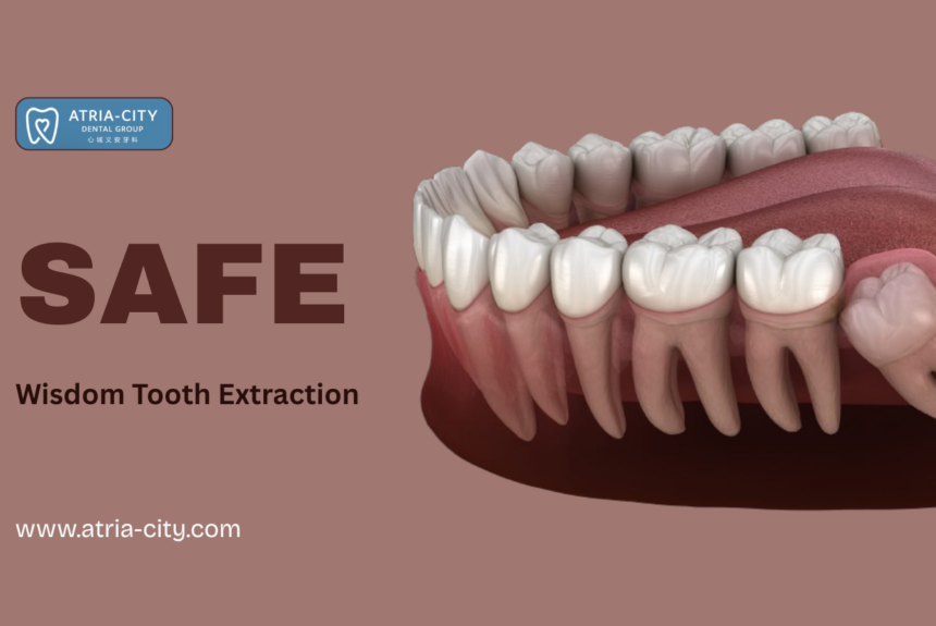 Safe Wisdom Tooth Extraction in Singapore Atria-City Safe Wisdom Tooth Extraction in Singapore | Atria-City
