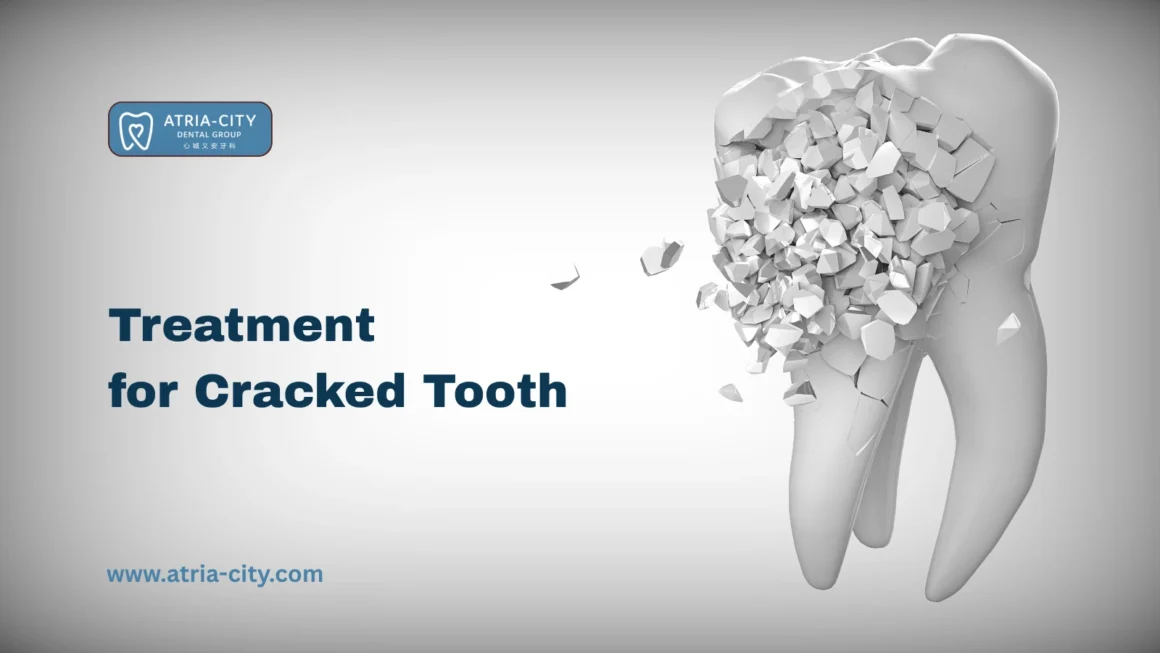 Treatment for Cracked Tooth in Singapore Atria-City