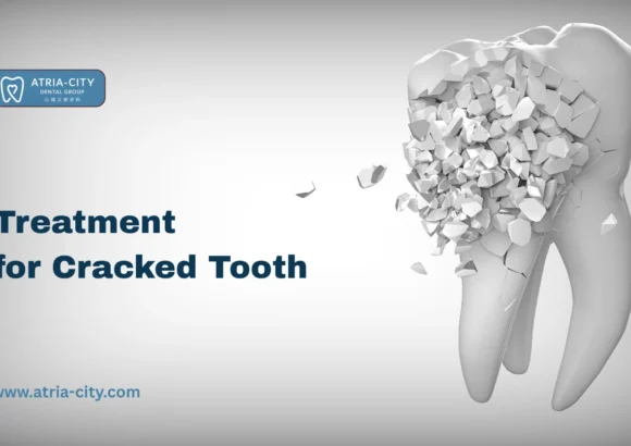 Treatment for Cracked Tooth in Singapore Atria-City
