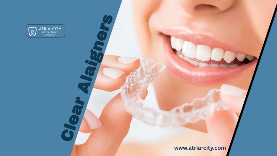 advanced Clear aligners treatments _ Atria-city Dental Group