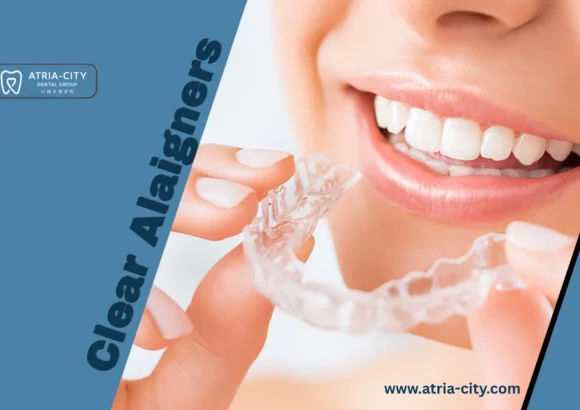 advanced Clear aligners treatments _ Atria-city Dental Group