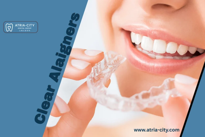 advanced Clear aligners treatments _ Atria-city Dental Group