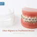 Clear Aligners vs Traditional Braces