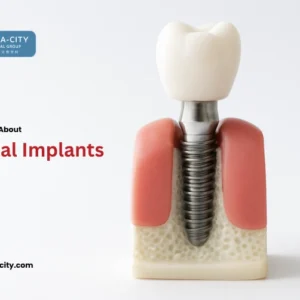 everything about dental implants