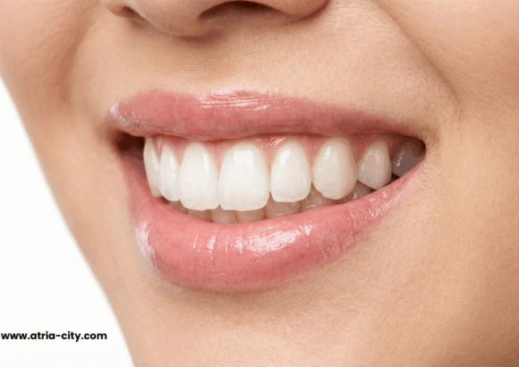 Teeth Whitening in Singapore (1)