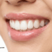 Teeth Whitening in Singapore (1)