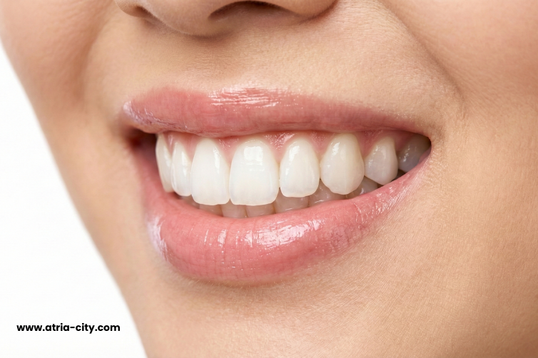 Teeth Whitening in Singapore Teeth Whitening in Singapore (1)