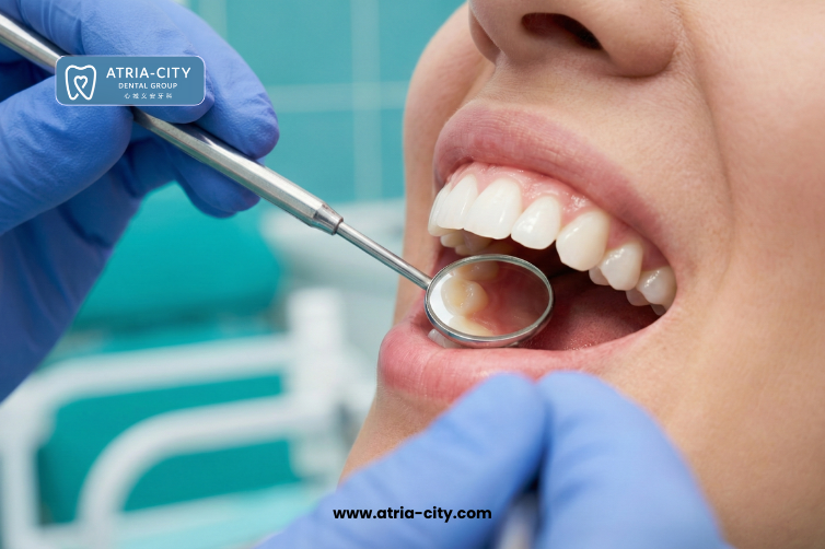 Gum Disease Treatment in Singapore Gum Disease Treatment in Singapore