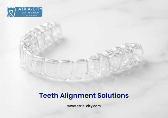 Teeth Alignment Options